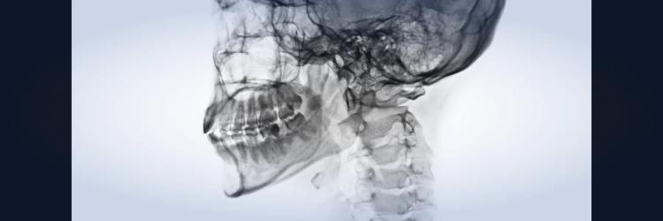 Program in Head & Neck Radiology