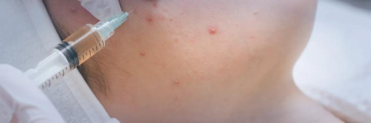 International Post Graduate Program In Advanced Dermatology