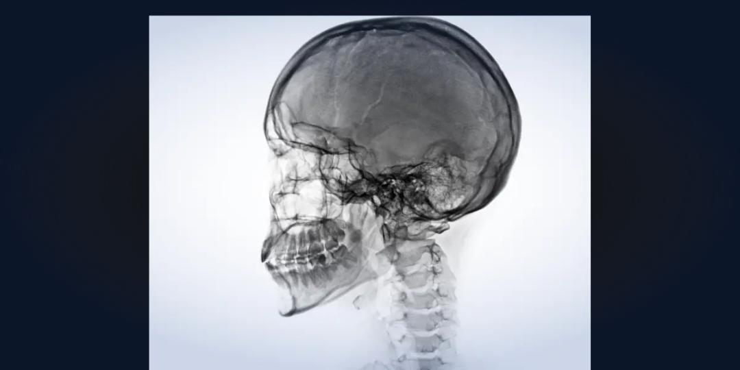 Program in Head & Neck Radiology