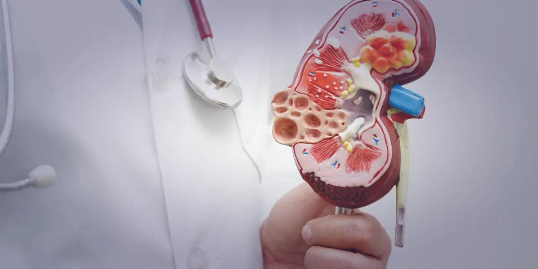 Postgraduate Diploma in Renal Medicine