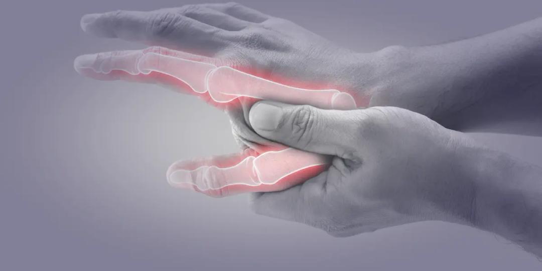 Postgraduate Diploma in Rheumatology