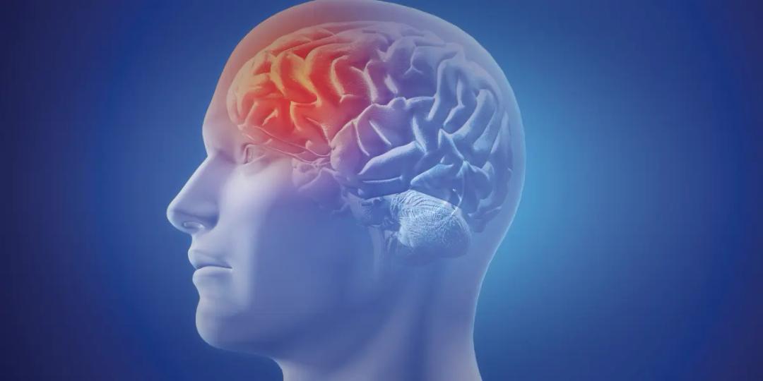 Postgraduate Diploma in Neurology