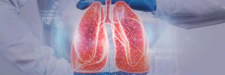 MSc in Respiratory Medicine