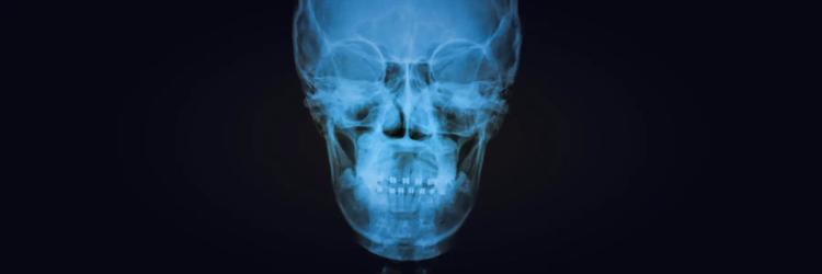 MSc In Craniofacial Trauma Reconstruction