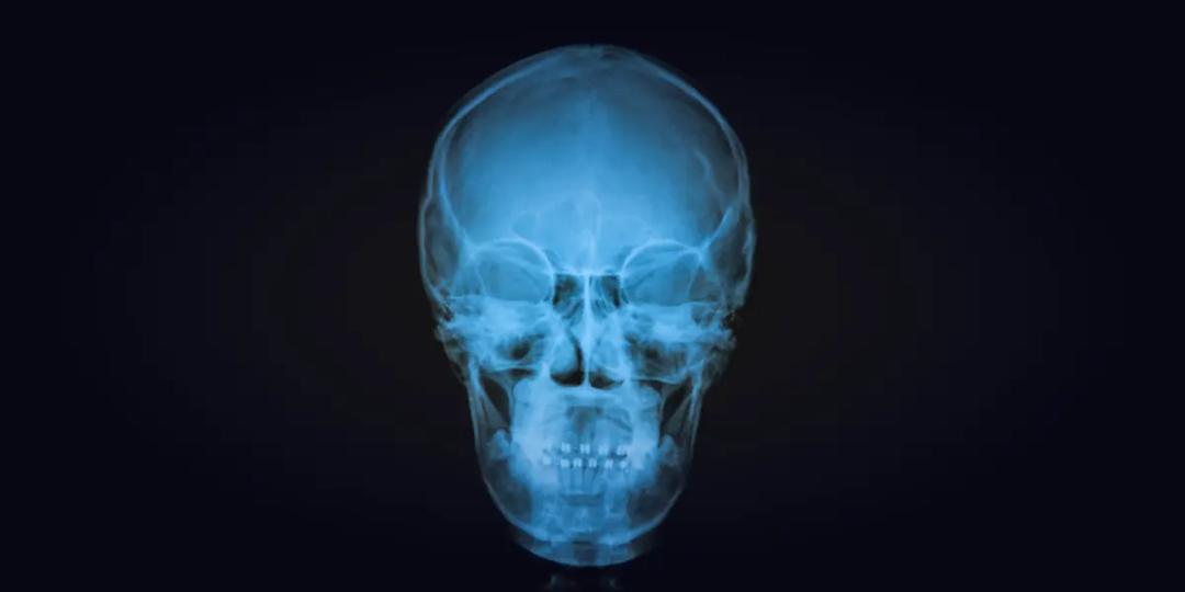 MSc In Craniofacial Trauma Reconstruction