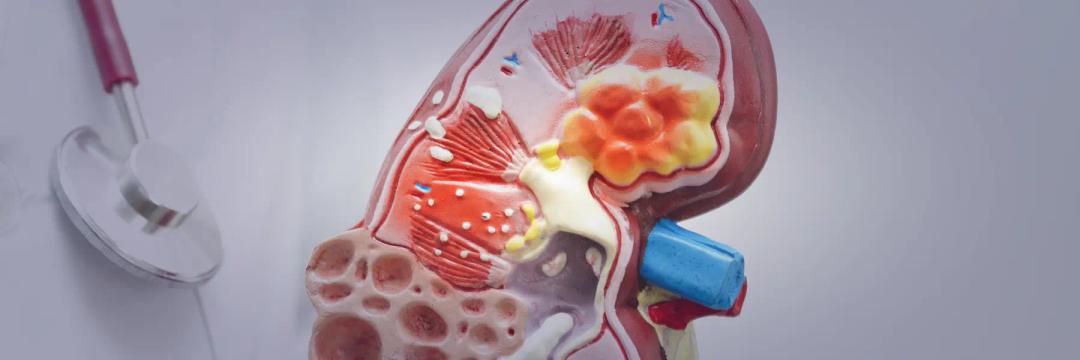 MSc in Renal Medicine
