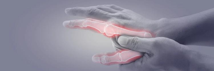 MSc in Rheumatology
