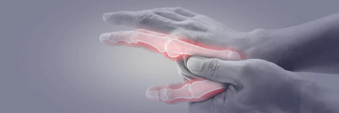 MSc in Rheumatology
